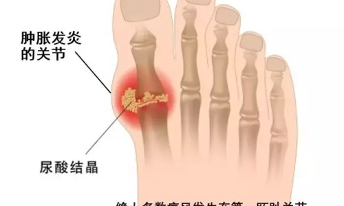 钻石风草药-钻石风的药用价值网-分享钻石风草药图片长什么样子，钻石风草药图片长什么样子知识库